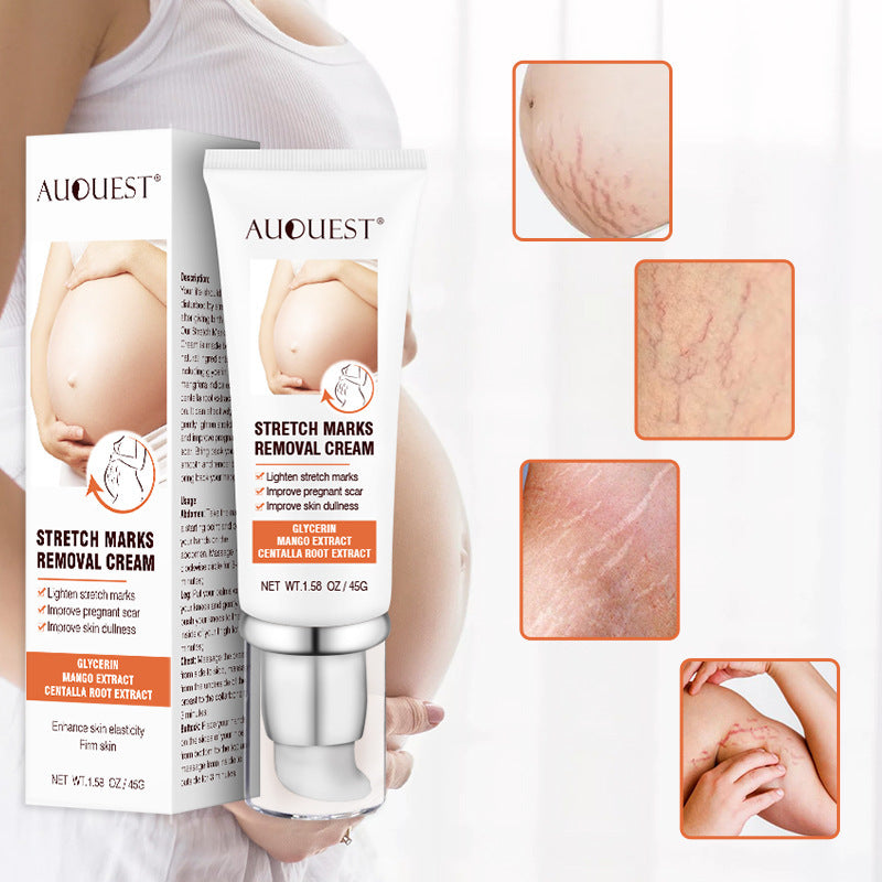 Entfernen Sie Schwangerschaftsnarben, Aknecreme, Dehnungsstreifenbehandlung, Mutterschaftsreparatur, Anti-Aging, Anti-Falten, straffende Körpercreme